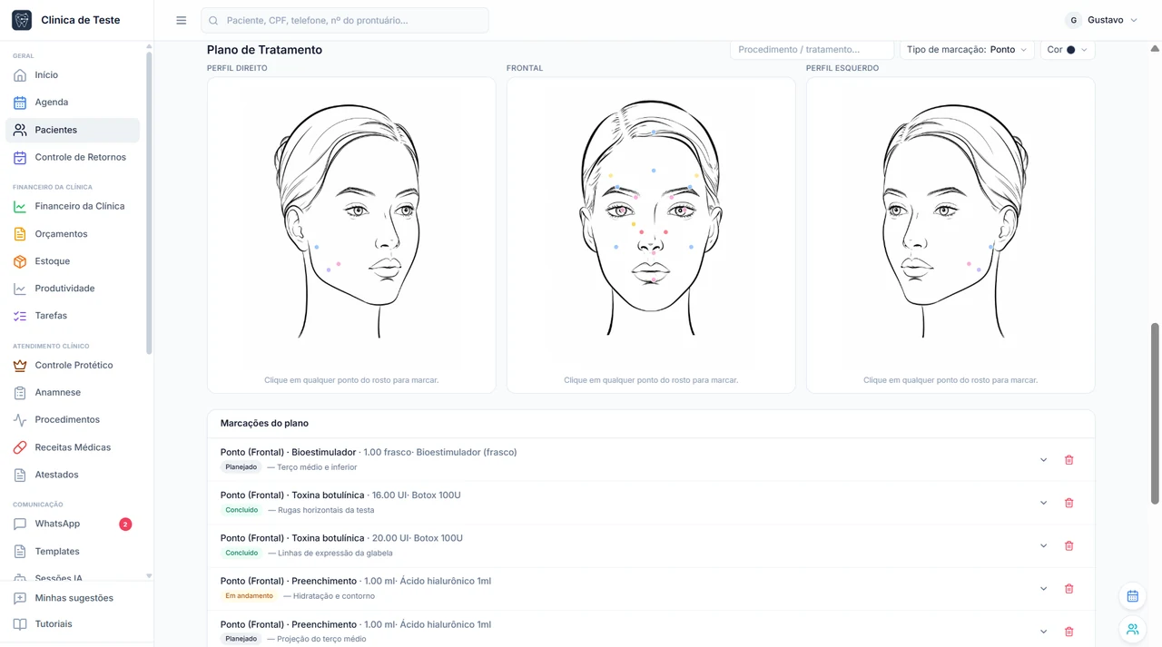 Ficha de análise facial com marcações coloridas por região e produto.